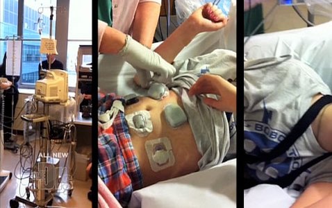 bionic_pancreas_technology